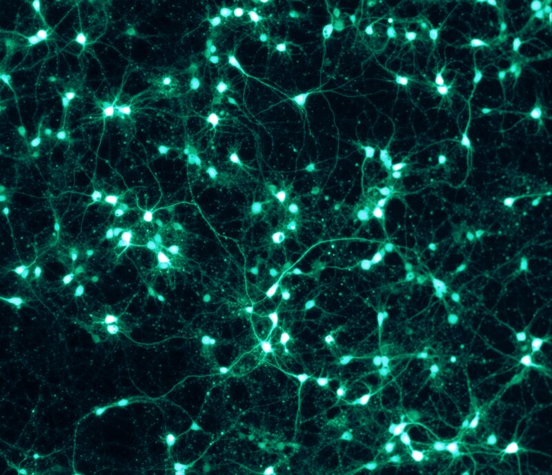Image de microscopie sur fond noir : de nombreux corps cellulaires lumineux verts reliés par un réseau de fins filaments.