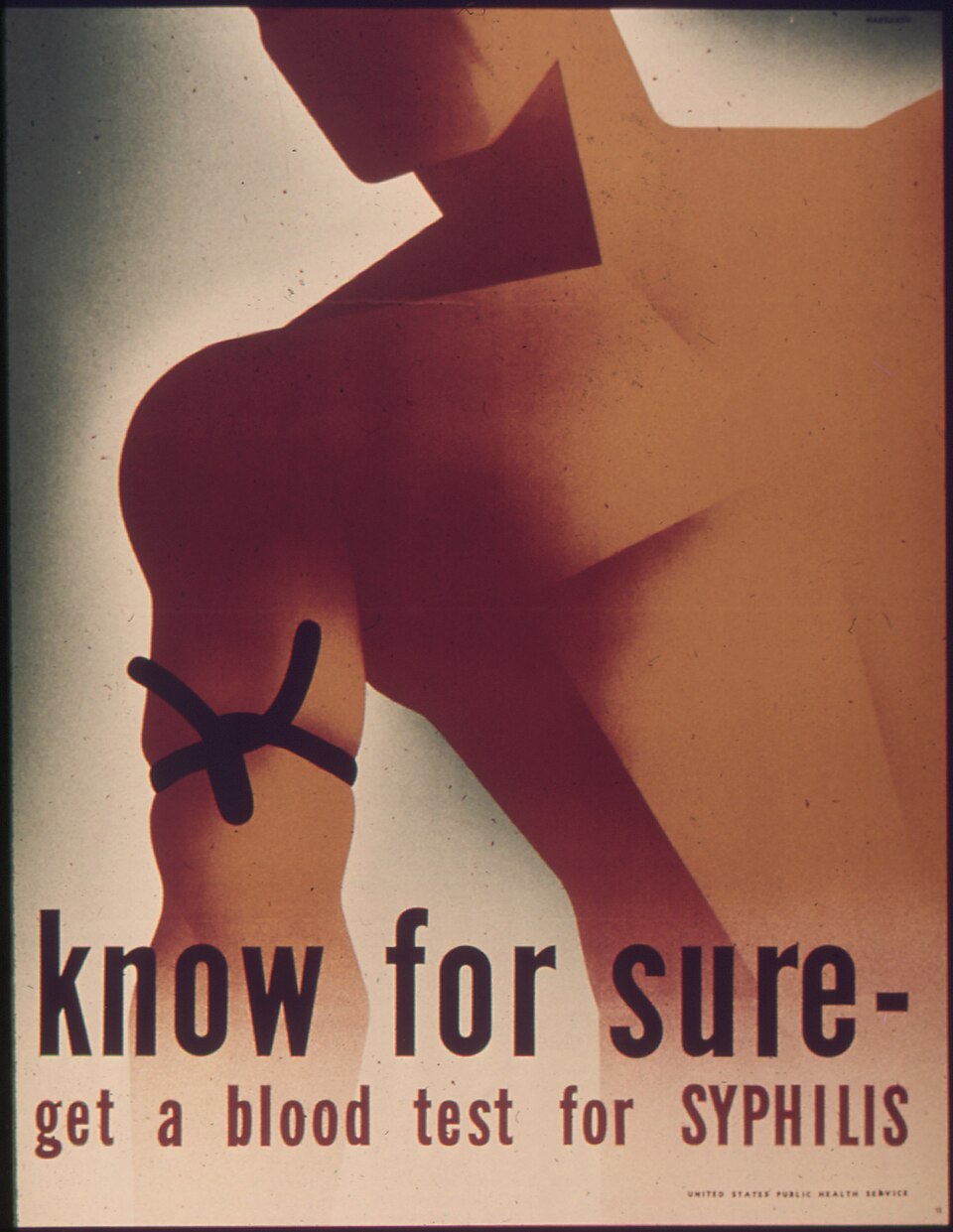 Affiche montrant un bras avec un garrot et le texte Know for sure, get a blood test for syphilis.